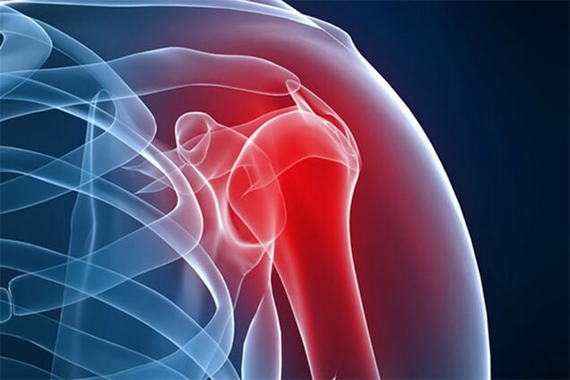 болка во рамото поради остеоартритис